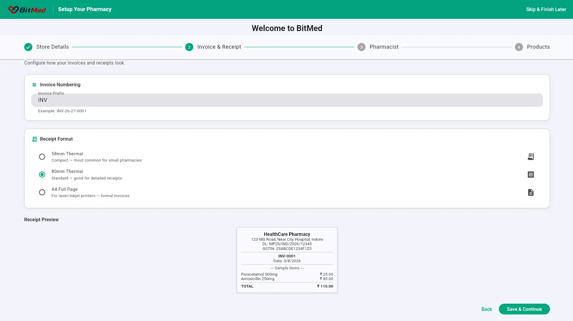 Wizard — receipt setup